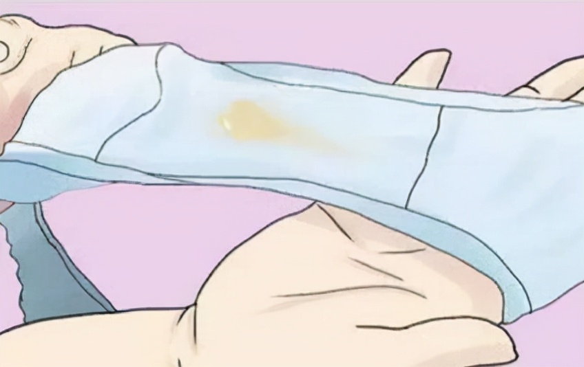 女人下身疾病的表现,女性妇科病毒感染症状