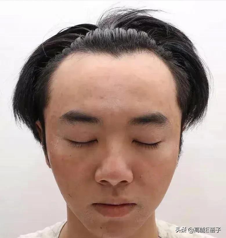 网友突然晒照曝华晨宇整容植发，还自称是其老婆，被张碧晨介入？