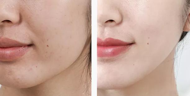 资生堂悦薇水乳流动性,资生堂悦薇水乳紧致抗老