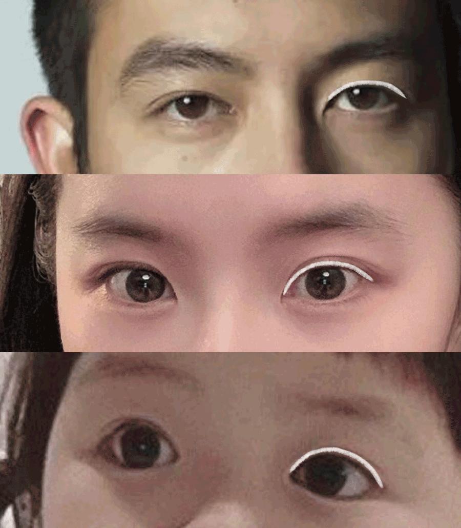 双眼无神怎么变得有神吃点什么,双眼无神怎么变得有神