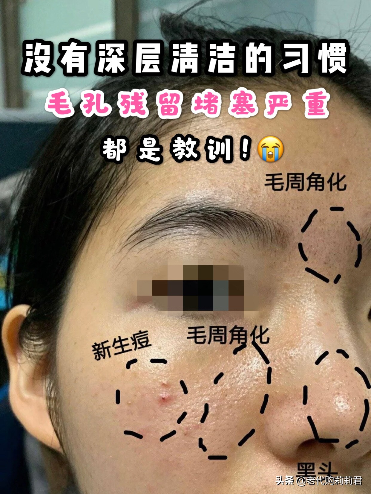 亲测！刘昊然、宋茜都觉得好用，这几款清洁面膜你真的不能错过鸭