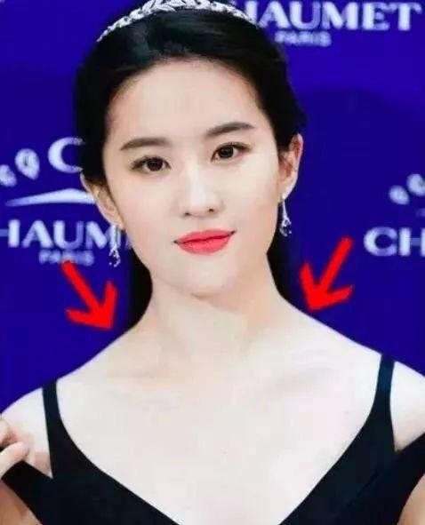 溜肩严重的明星,溜肩毁身材4招帮你改善圆肩