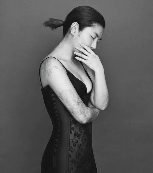 selina任家萱回四川,selina任家萱伤疤好了吗