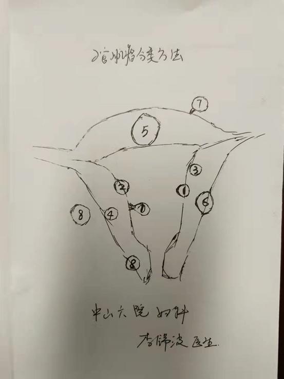 做子宫肌瘤手术多少钱,子宫肌瘤吃什么药能消除