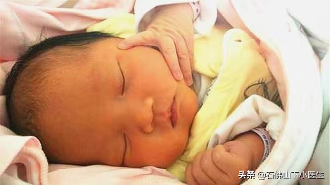 黄疸新生儿要测多久,新生儿黄疸必知