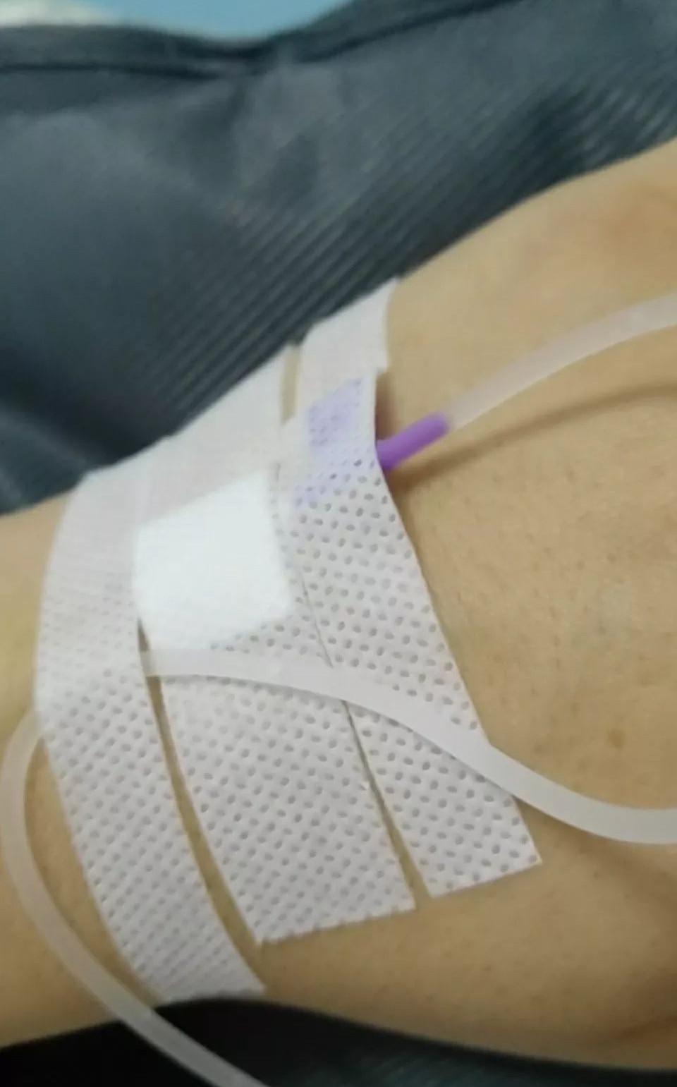 输液拔针为什么会很疼,输液拔针疼哭