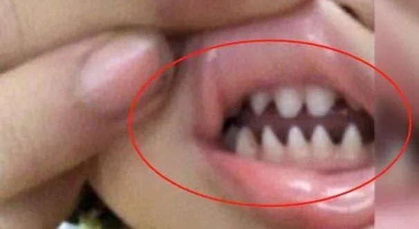 儿童护牙食谱大全,儿童保护牙齿食谱图片大全