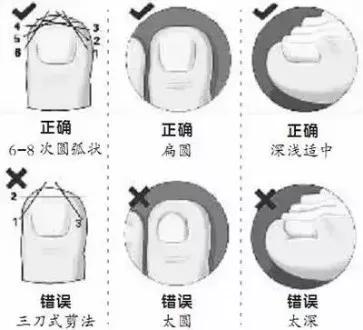 跑步跑出黑指甲怎么处理,跑步后脚趾甲充血变黑怎么办