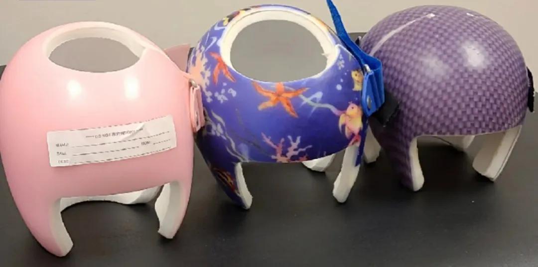 婴儿戴头盔矫正头型变畸形,婴儿戴摩托头盔