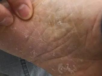 沈腾推荐治疗腿疼,沈腾的神奇功效