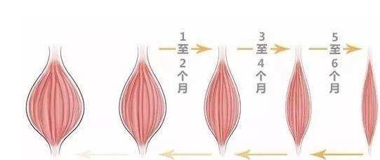 瘦脸针怎么避开腮腺,瘦脸针僵硬感怎么解决