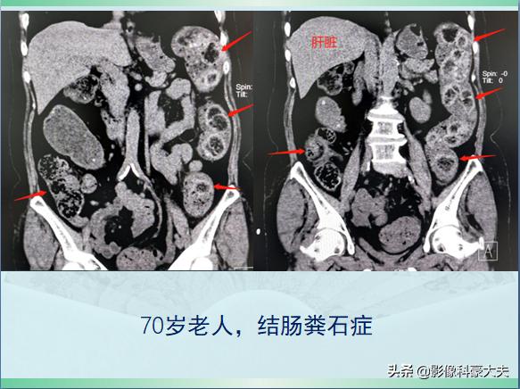 老人去世送盘缠是什么意思,老人去世送盘缠怎么说