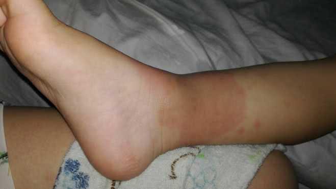 宝宝从80厘米床掉下来怎么办,婴儿坠床摔到头后多久脱离危险