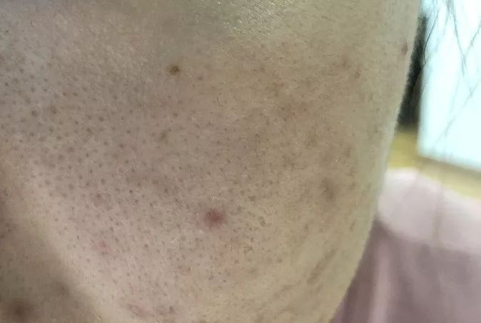 李佳琦推荐超值遮毛孔神器！韩国限量款，明星裸妆轻松打造