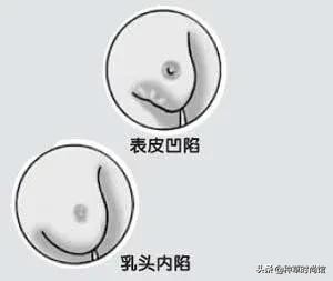 女性胸部知识你知多少,女性胸部知识科普