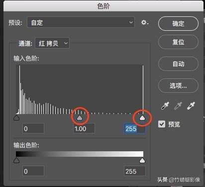 抠头发,快速高效的抠发方法传授给你
