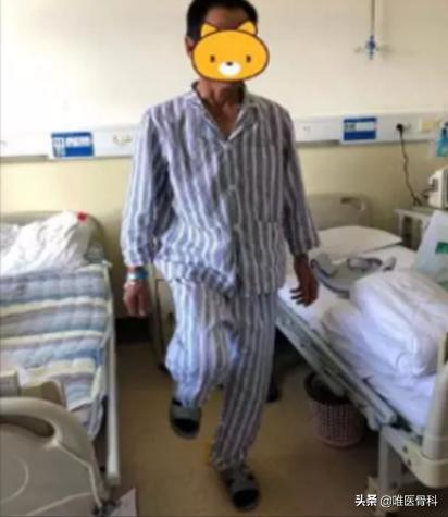 腰椎滑脱手术后卧床几天,一般腰椎滑脱手术需要卧床多久