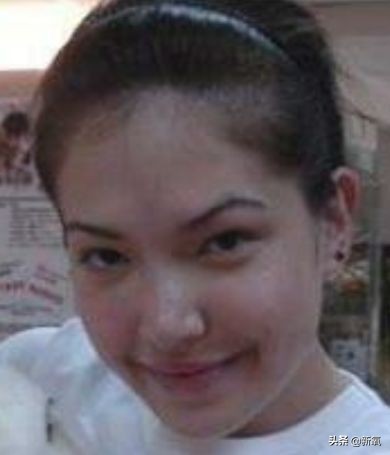 盘点整容后不敢认的女星颜值巅峰,知名女网红被扒整容