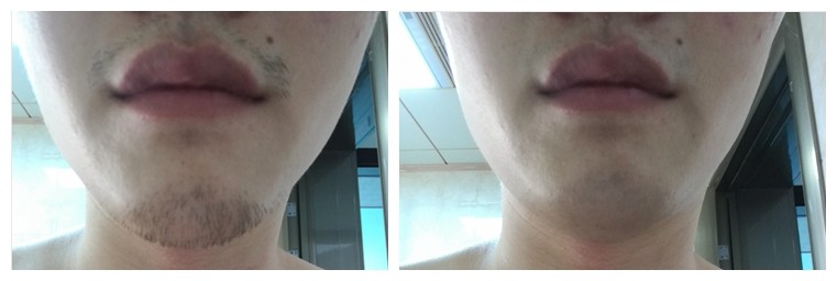 面子电动剃须刀,最有面子的电动剃须刀