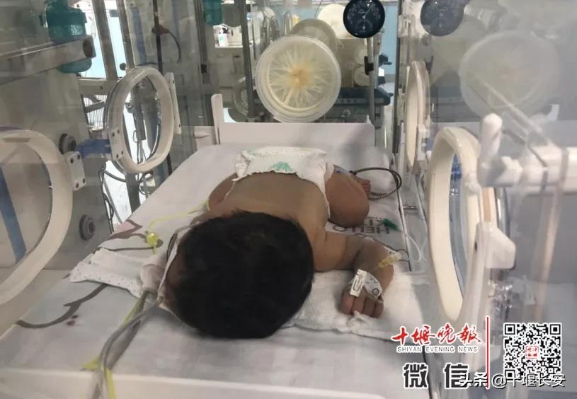 刚出生就换血怎么回事,出生10天全身换血严重吗