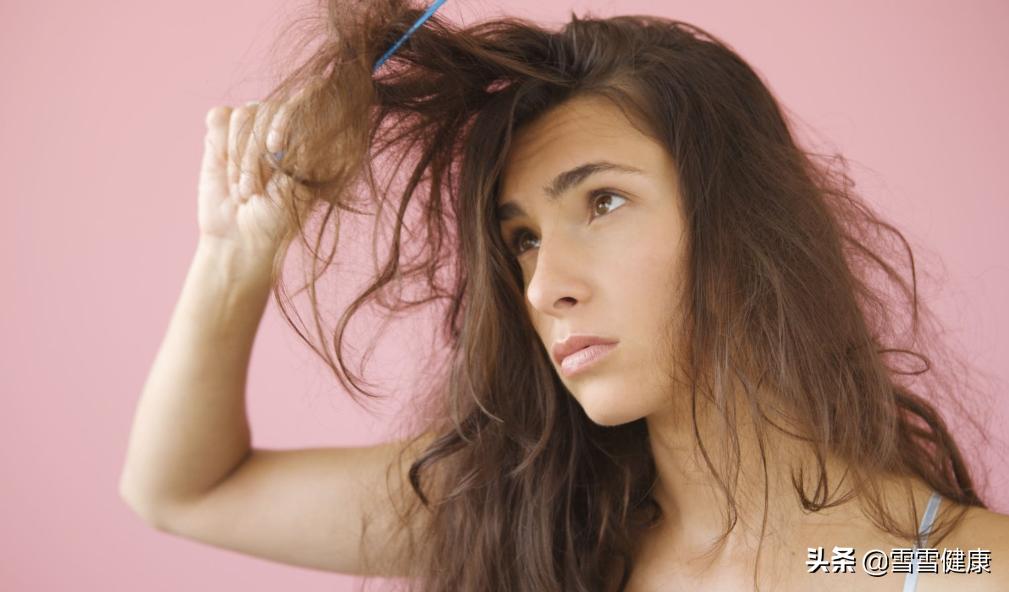 如何治疗脱发和头屑,起头屑脱发怎么办