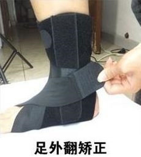 孩子足外翻通过训练可以痊愈吗,孩子轻微足外翻怎么办