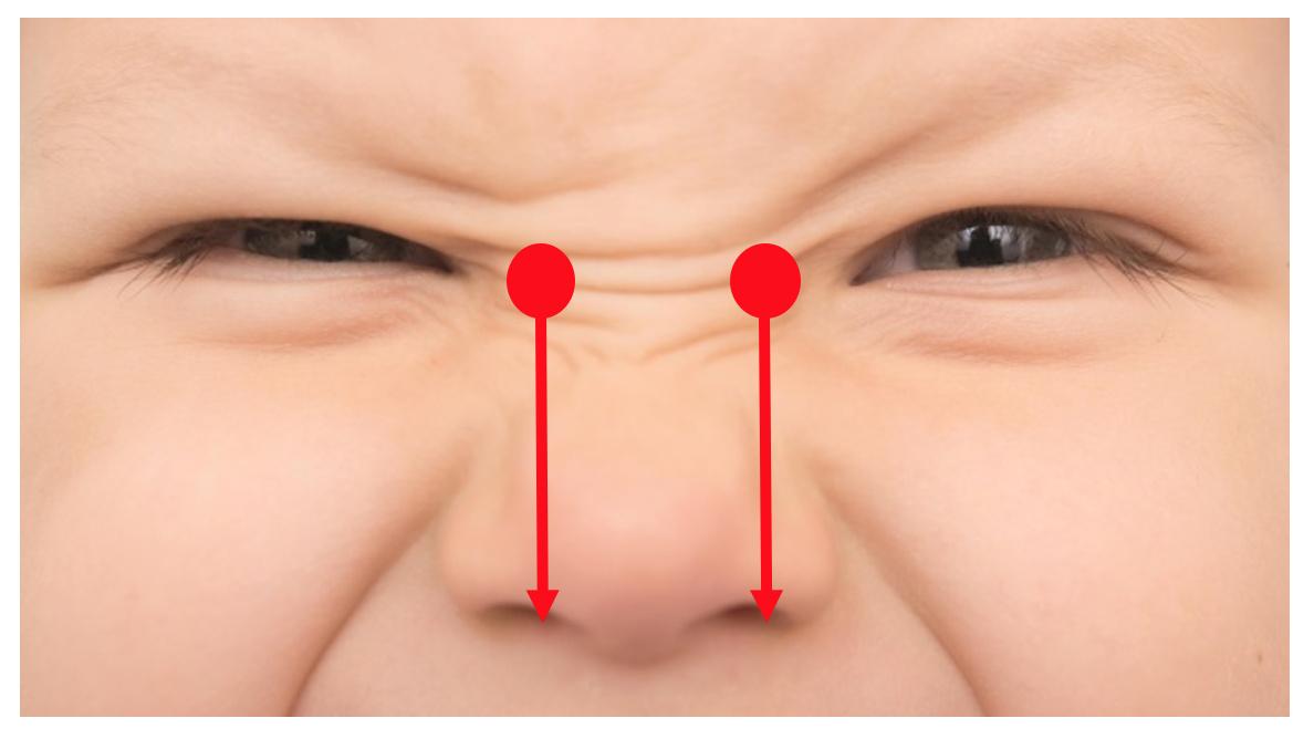 鼻头大怎么按摩变小图解,鼻头捏大的补救办法