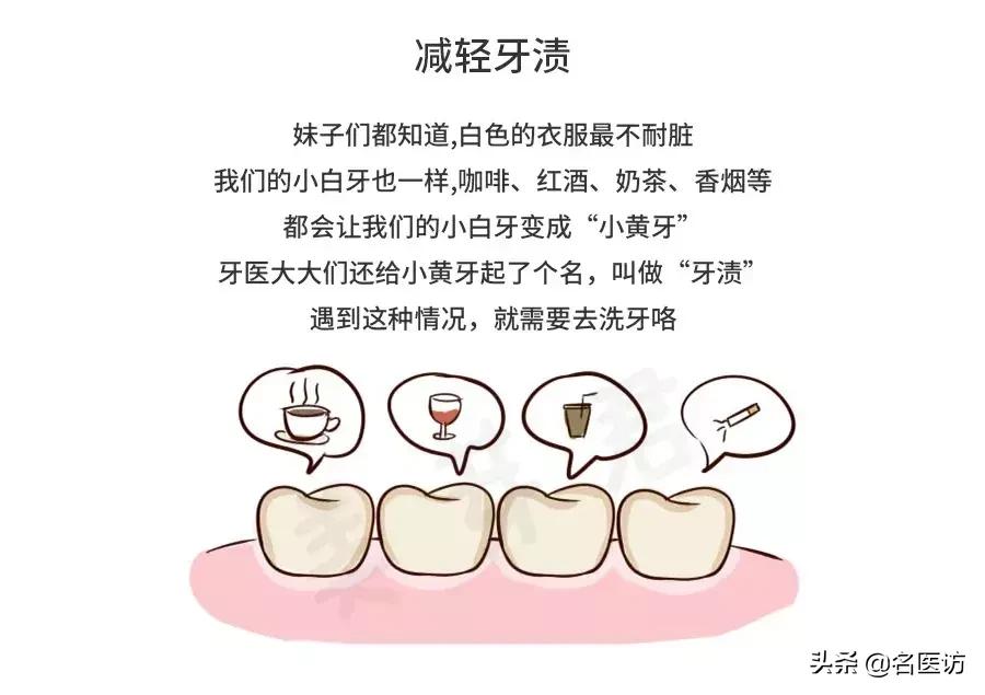 洗牙攻略,洗牙全攻略