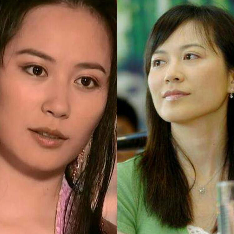 哪个明星做了颧骨内推,颧骨内推明星前后对比