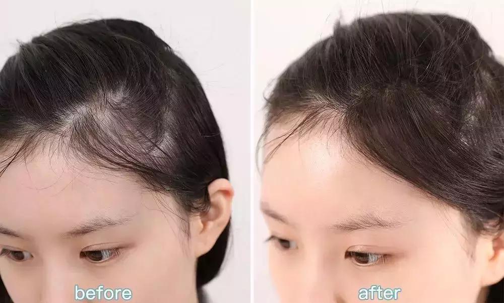 金晨和张歆艺熟吗,金晨晒多张合影为张歆艺庆生