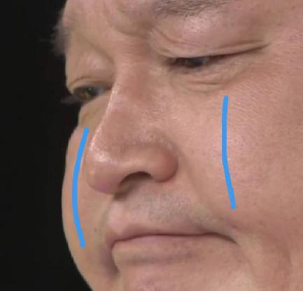 石原里美同款“钻石下颌线”，7天到位