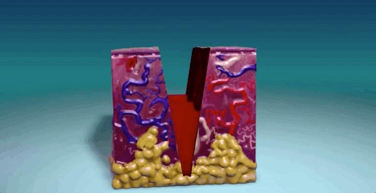 怎么恢复愈合伤口留下的疤痕,科普短片伤口是如何愈合的