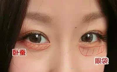 脸部卧蚕什么样,卧蚕都有哪些类型