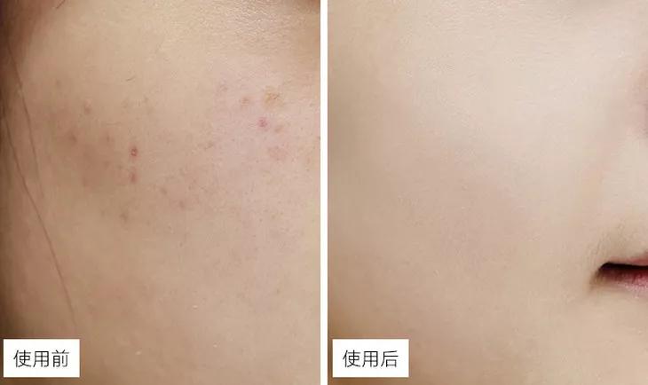 日本蜂王乳面霜,日本的霜好用不过敏干性皮肤用