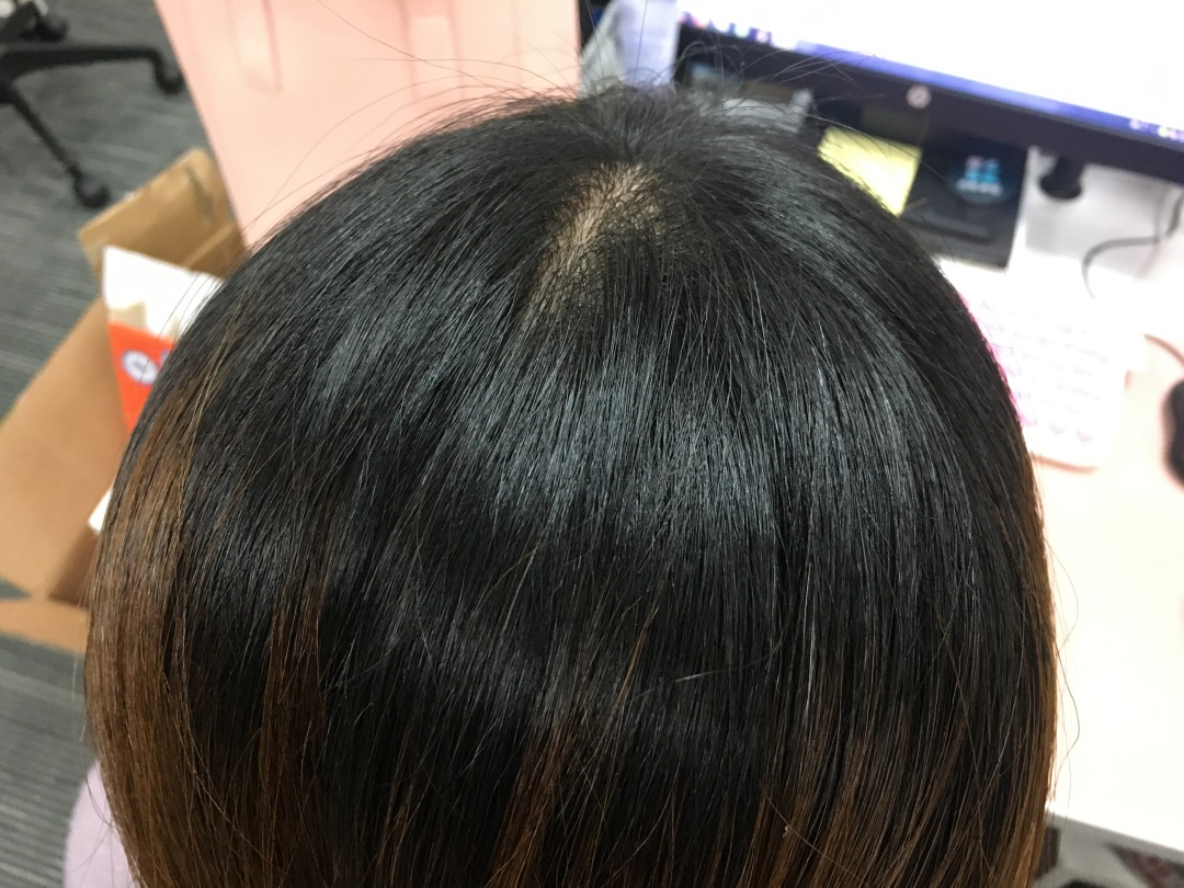 比较好用的德国防脱发,德国十大最好用的护肤品