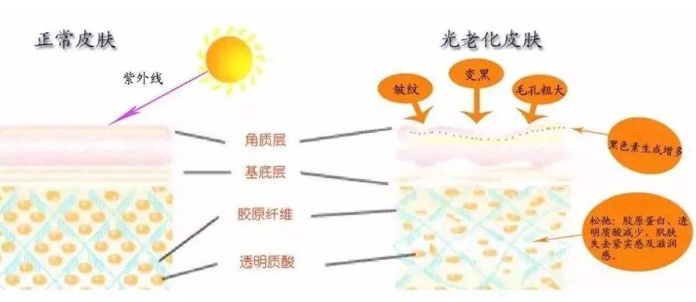 脸容易暗沉用什么粉底,皮肤暗沉不想化妆怎么办