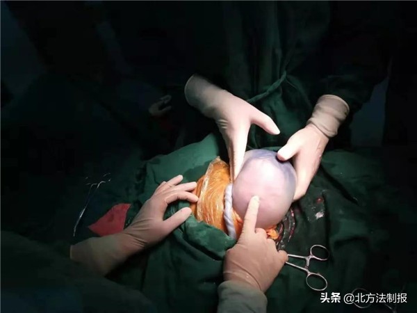 36周产下男婴肚子里还有哪吒,哪吒在娘胎里怀孕三年半才出生