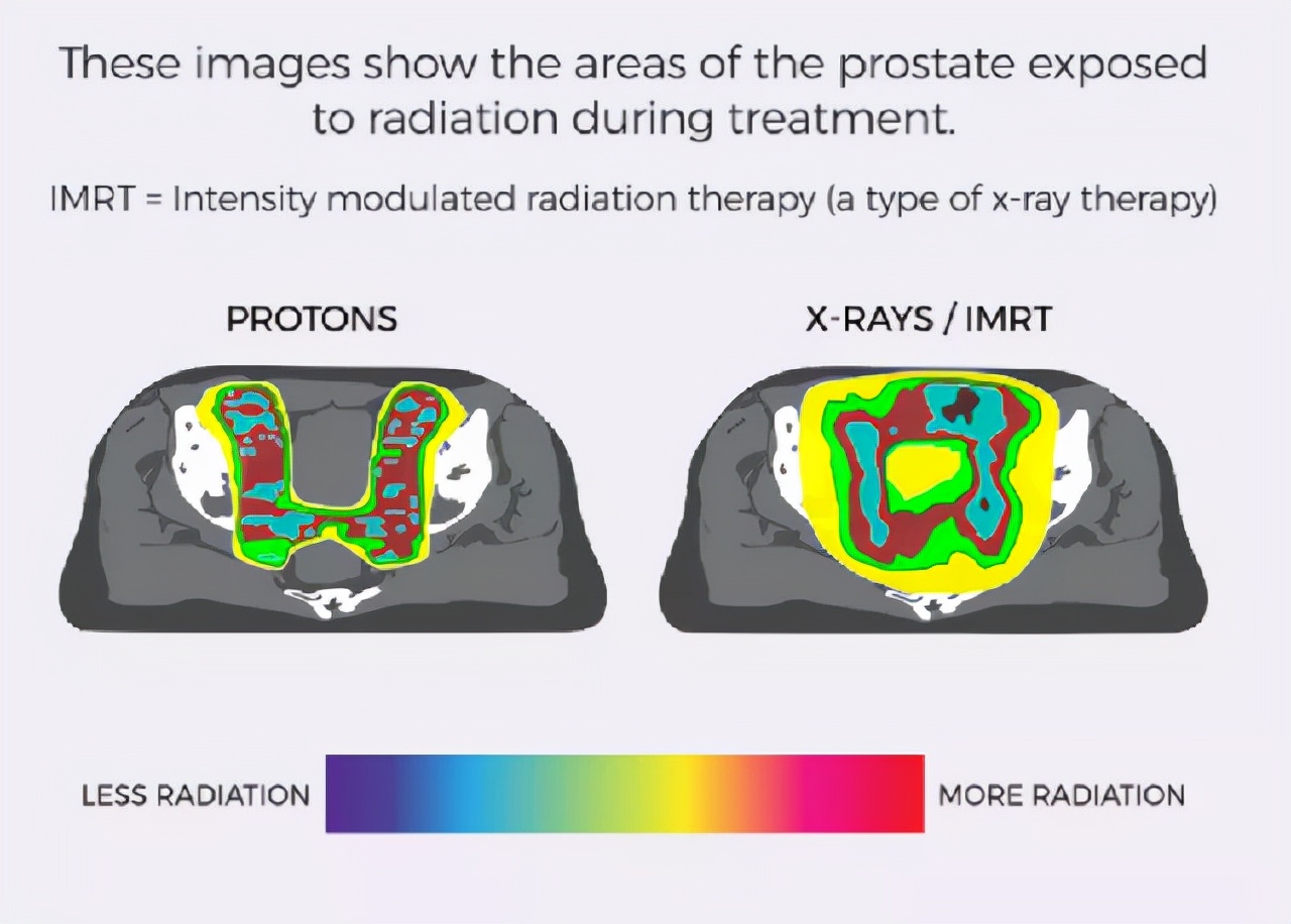 一级脑干胶质瘤,脑干胶质瘤指南