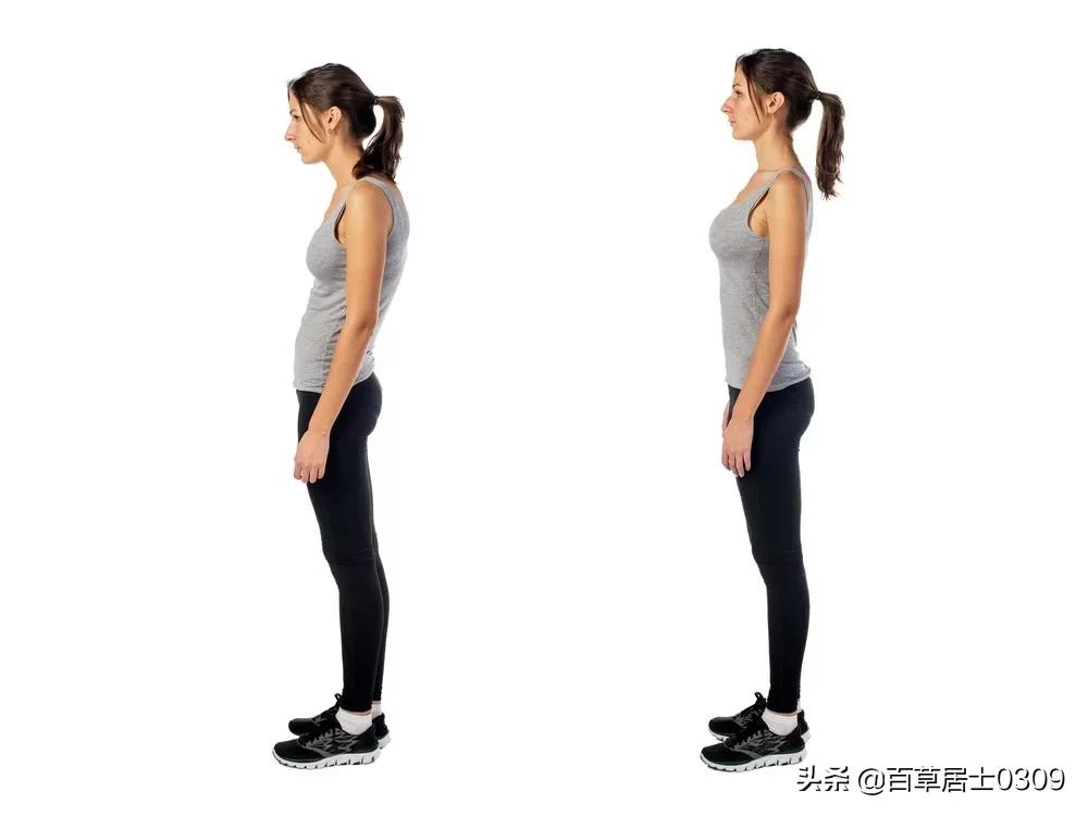 长期驼背导致脊椎凸起怎么办,年纪轻轻就驼背怎么矫正
