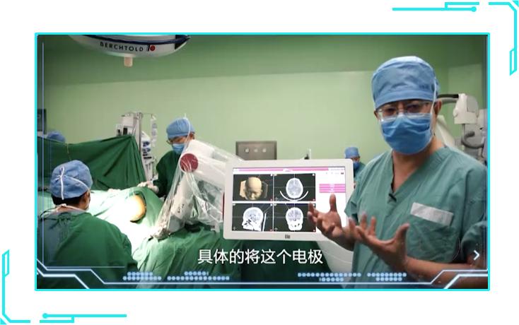 40多岁记忆力下降是痴呆的征兆吗,怎么分辨记忆力下降和老年痴呆