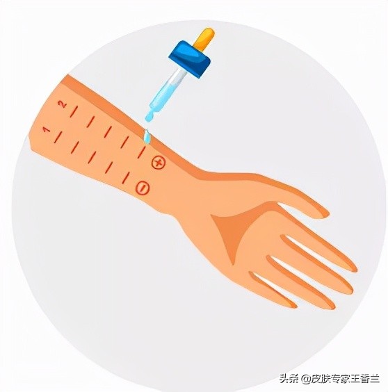 过敏去皮肤科主要检查什么,过敏就诊皮肤科应该怎么说