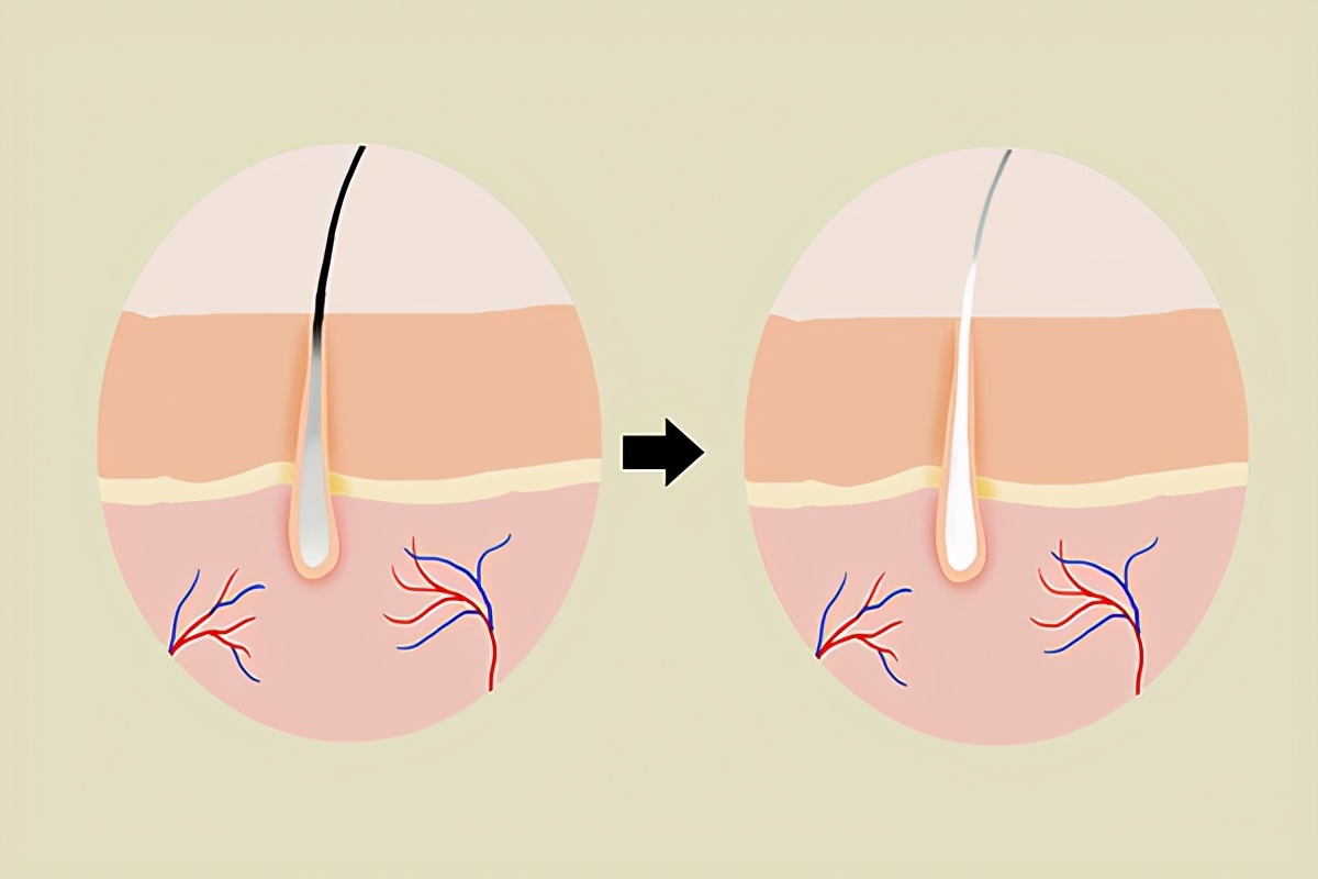 中医对两鬓白发的解读,两鬓长白发是衰老的迹象吗