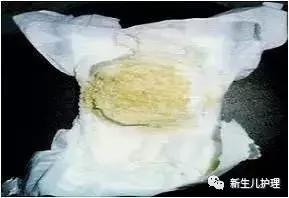 新手爸妈｜奶瓣、绿便、腹泻、便秘……宝宝各种便便真图全解必备