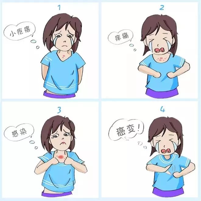 夏天疤痕治疗怎么做,夏季疤痕如何护理