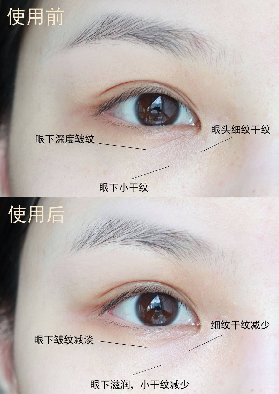 hih视黄醇精粹抗皱眼霜有效果吗,含a醇玻色因视黄醇的眼霜推荐