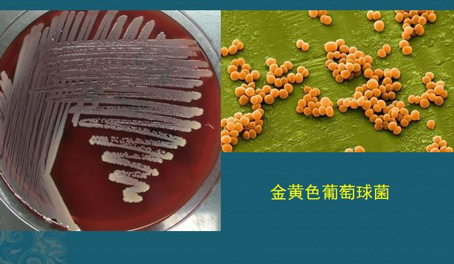 路边的野店不要去，花钱多，有些针还伤身体……