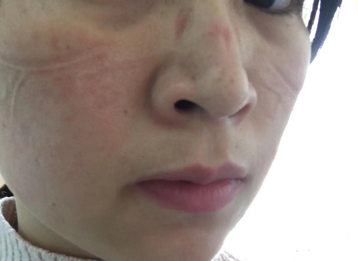 他们都是病毒“猎手”—记奋战在检疫一线的安庆市立医院检验科