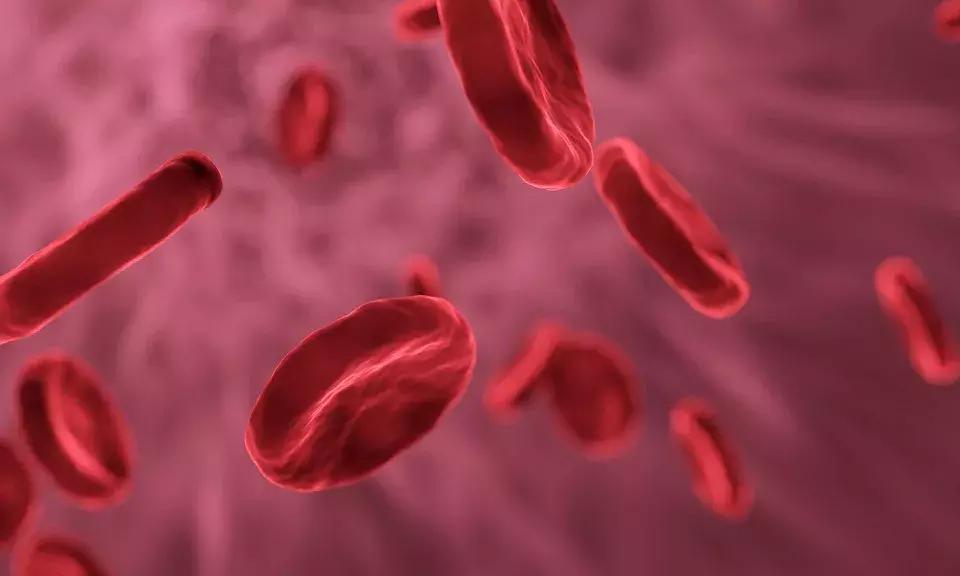 抽血颜色发黑是什么原因,抽血血液颜色发黑怎么回事