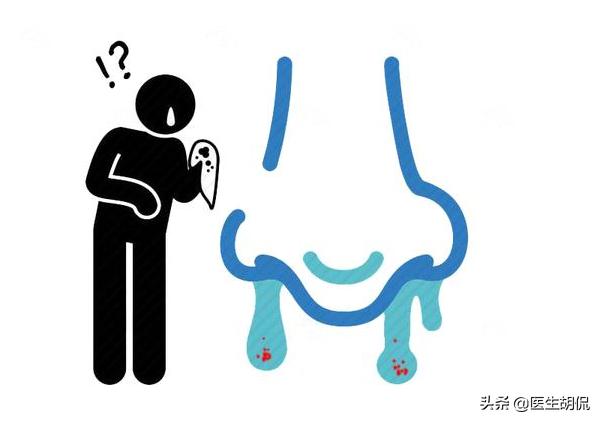 不明原因疼痛警惕癌症,生理变化或是癌症前兆