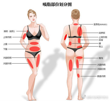 吸脂疼吗,面部吸脂一年多还痛